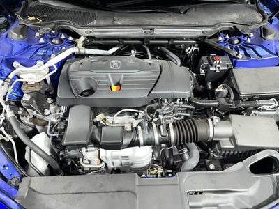 2025 Acura TLX w/A-Spec Package
